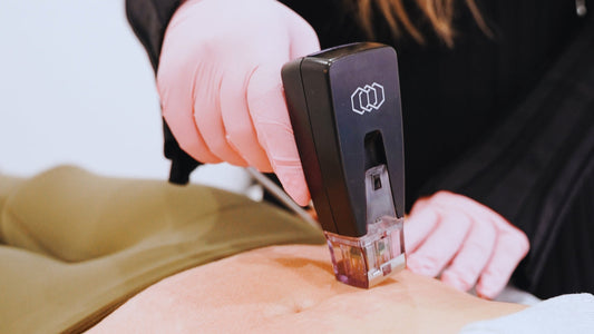 How to Get Your Skin Summer Ready in 2025