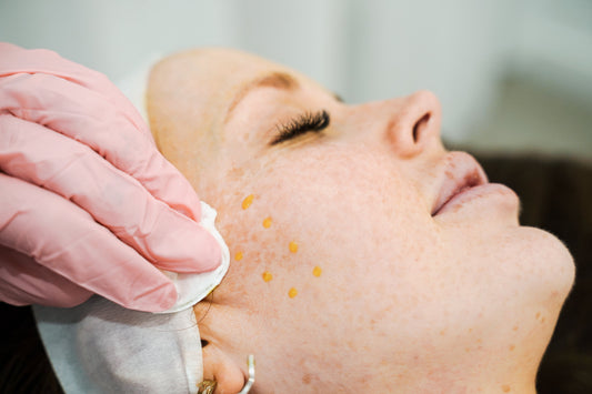 Best Morpheus8 Treatment in Essendon, Melbourne, Australia