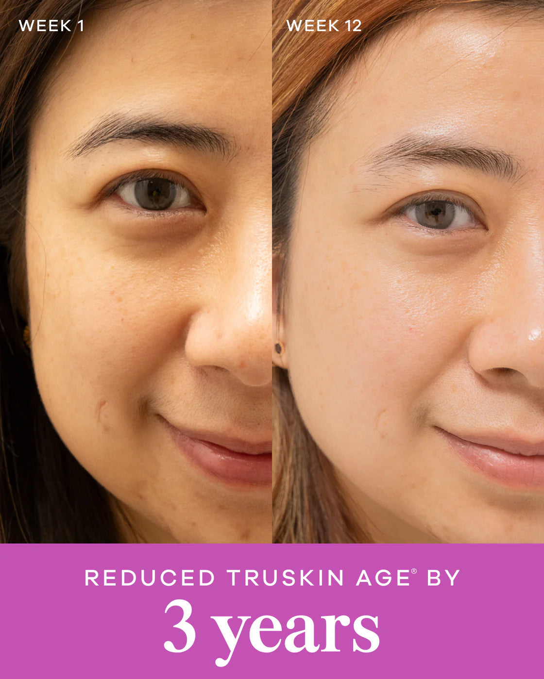 Before and After Using Vida Glow Collagen Liquid Advance