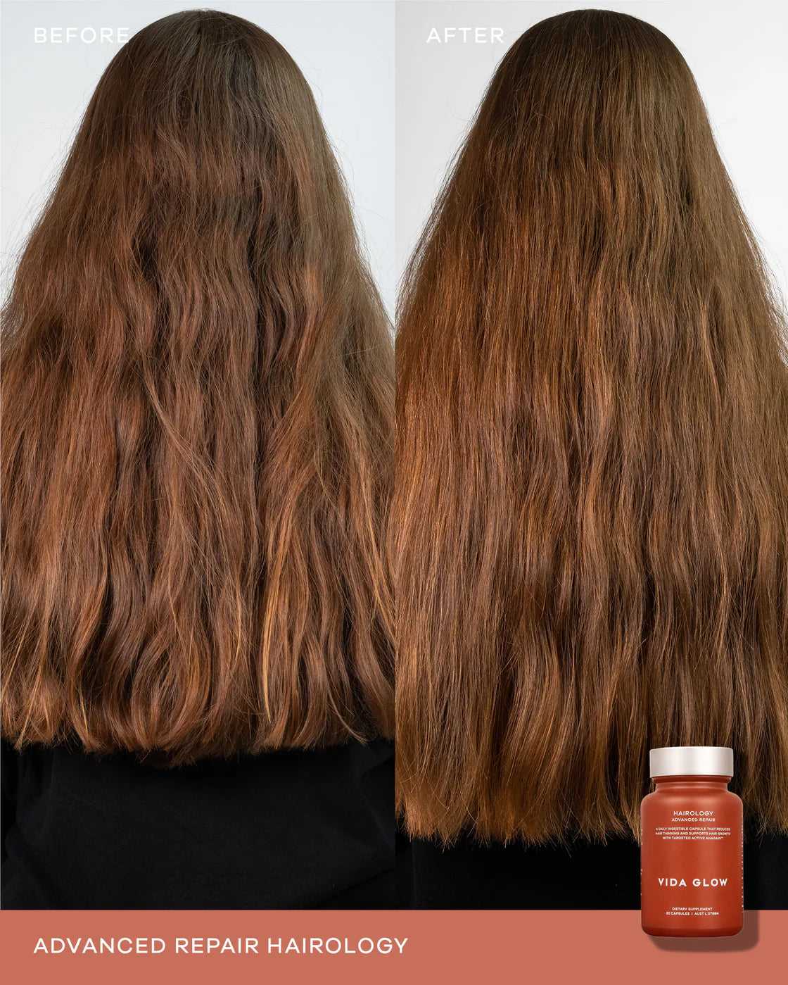 Vida Glow Hairology Capsules