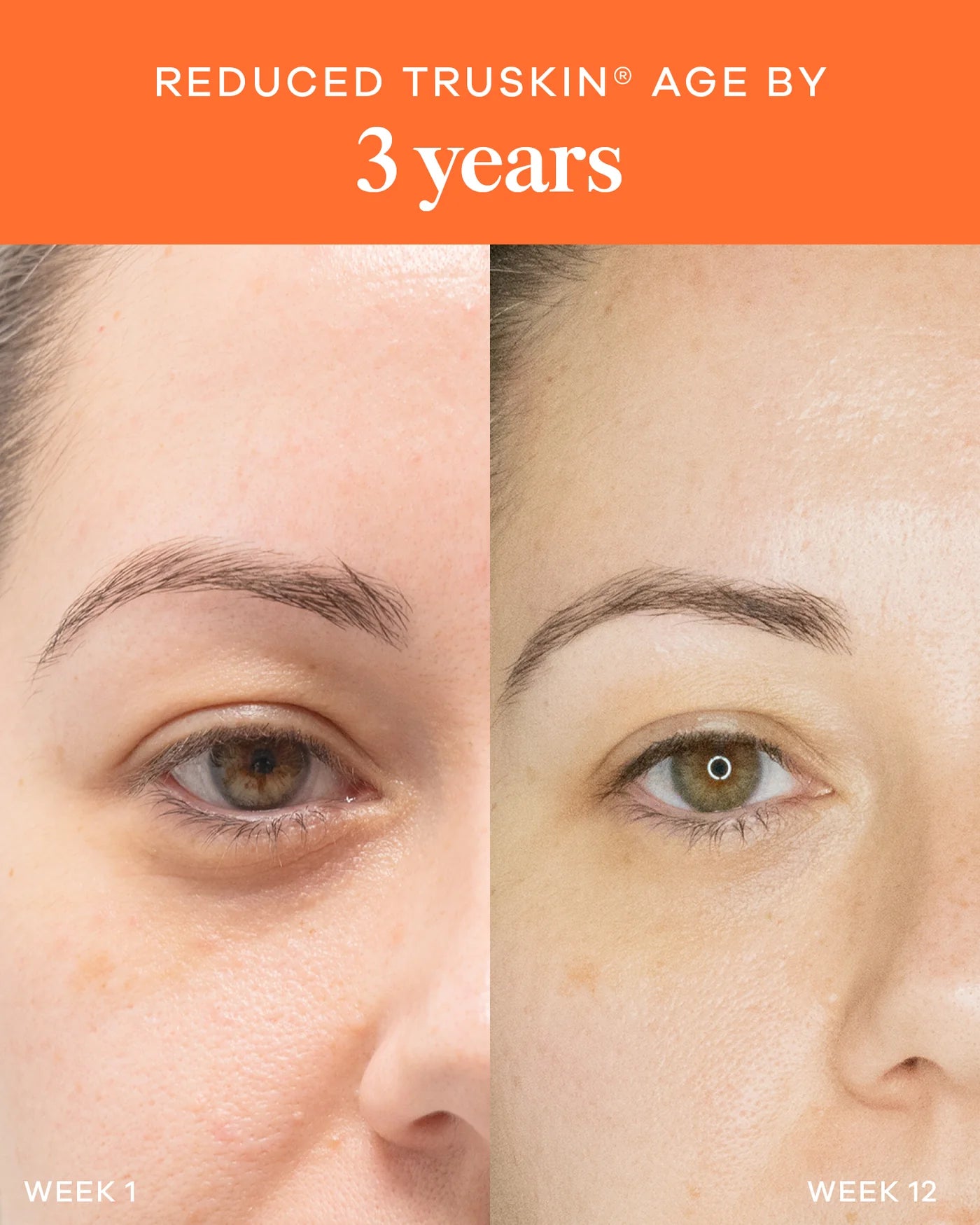 Vida Glow Collagen Tropical Liquid Advance in Melbourne, Australia