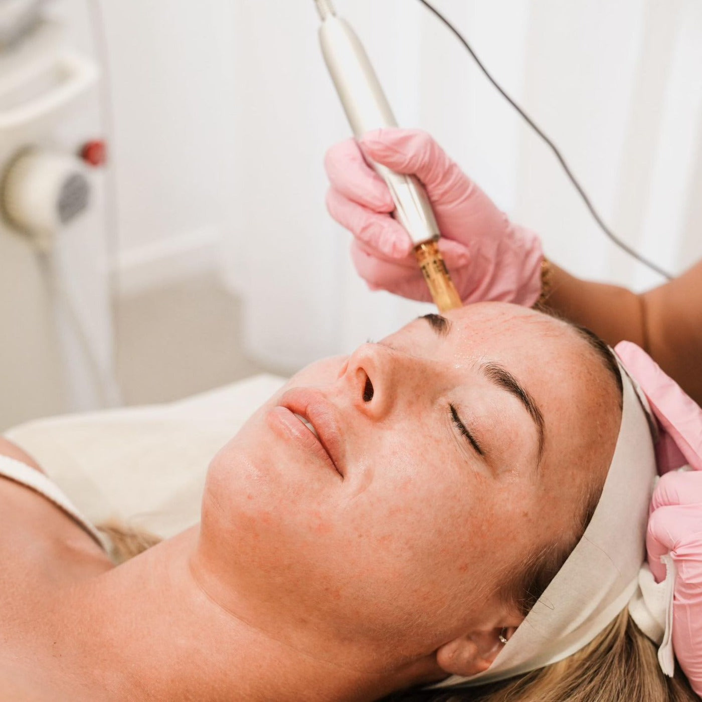 SKIN NEEDLING Skin Bottega