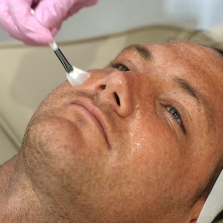 Mesoéclat Skin Peel in Melbourne