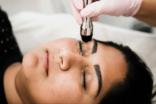 Cutera Laser Genesis Treatment in Melbourne, Australia