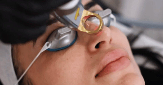 Cutera Laser Genesis Treatment in Melbourne, Australia