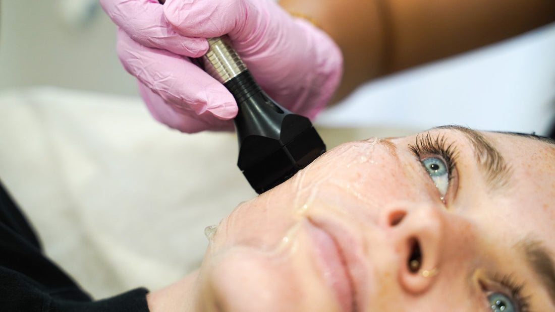 Forma RF Skin Treatment in Melbourne: What You Should Know