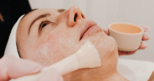 Laser Skin Treatment vs Chemical Peel