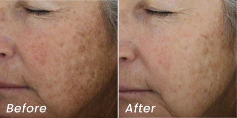 Alastin A-Luminate Brightening Serum