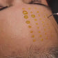 BioRePeel treatment in Essendon, Melbourne