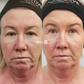 Biofiller Super8 Hydrating Facial - Insider Access Sale