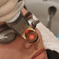 CoolView - Laser Treatment