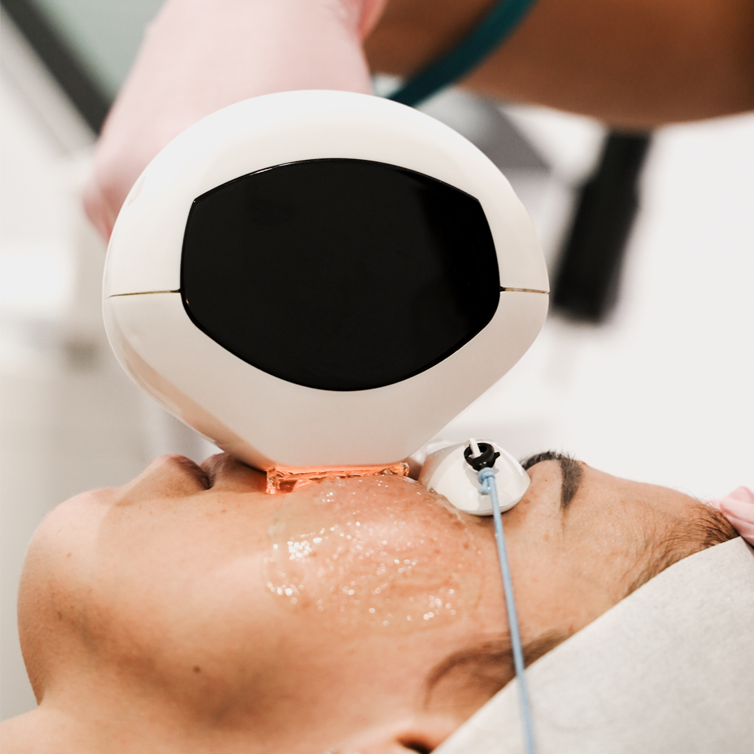 Lumecca IPL in Melbourne