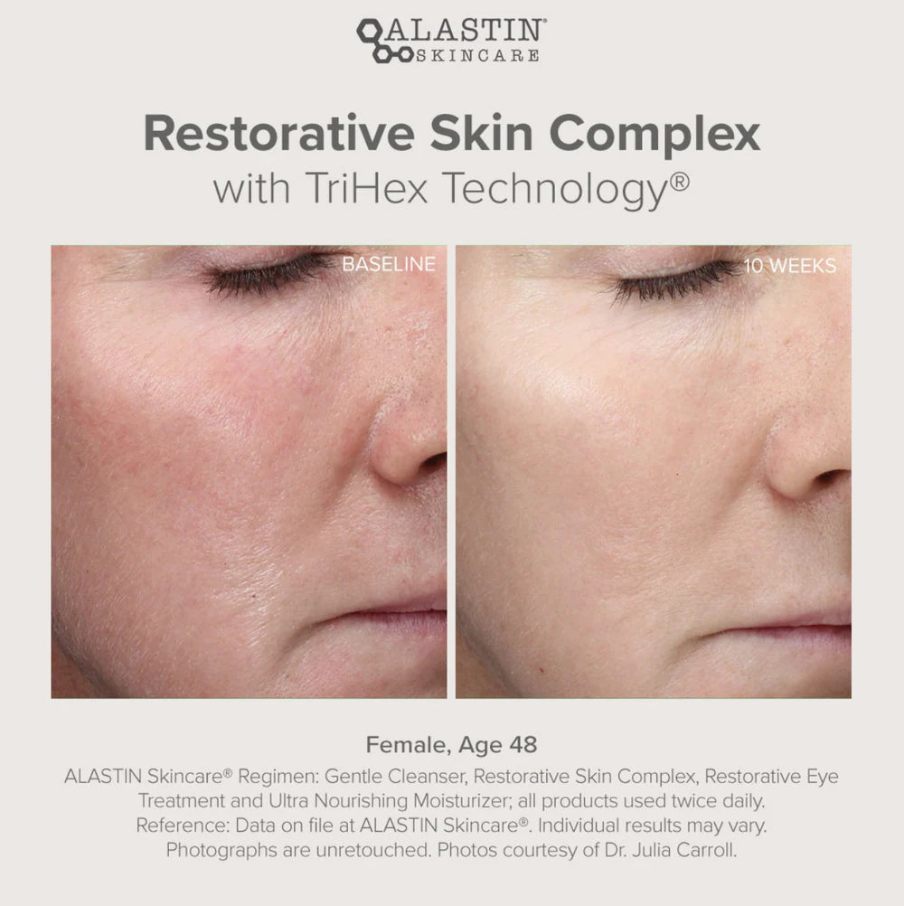 Alastin Restorative Skin Complex in Melbourne, Australia