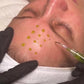 Skin Bottega BioRePeel facial