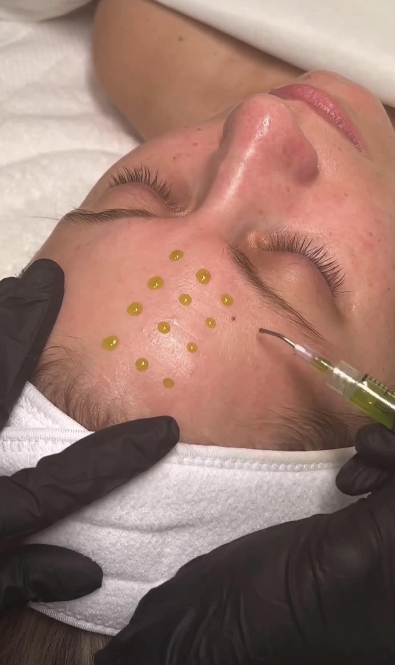 Skin Bottega BioRePeel facial