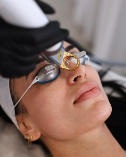 Laser Genesis by Cutera