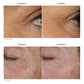Alastin Restorative Eye Complex in Melbourne, Australia