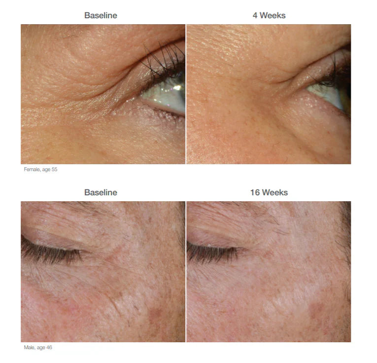 Alastin Restorative Eye Complex in Melbourne, Australia