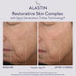 Alastin Restorative Skin Complex in Melbourne, Australia