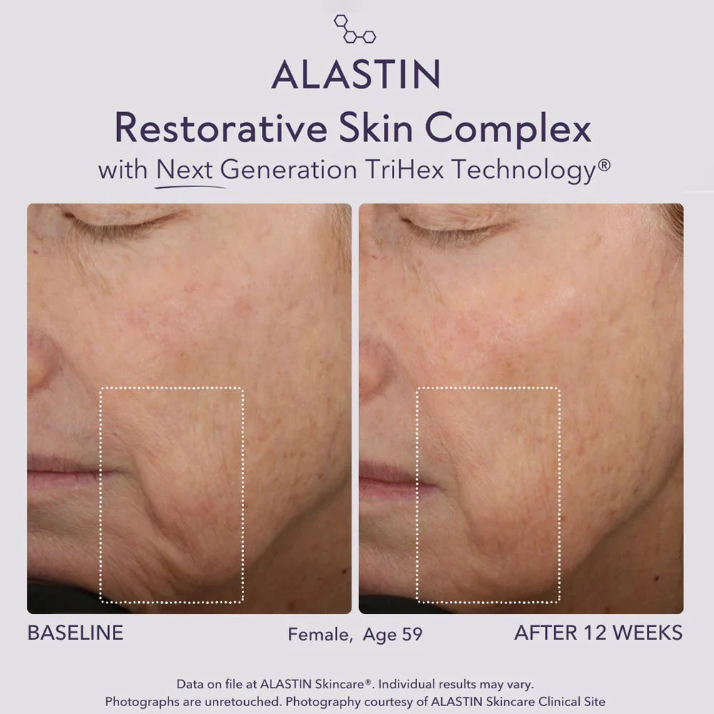 Alastin Restorative Skin Complex in Melbourne, Australia
