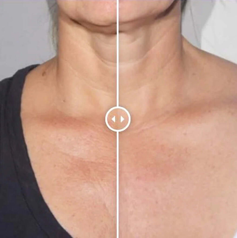 Alastin Restorative Neck Complex