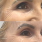 Rejuran - Salmon DNA Treatment - EOFY Edit