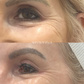 Rejuran - Salmon DNA Treatment - EOFY Edit